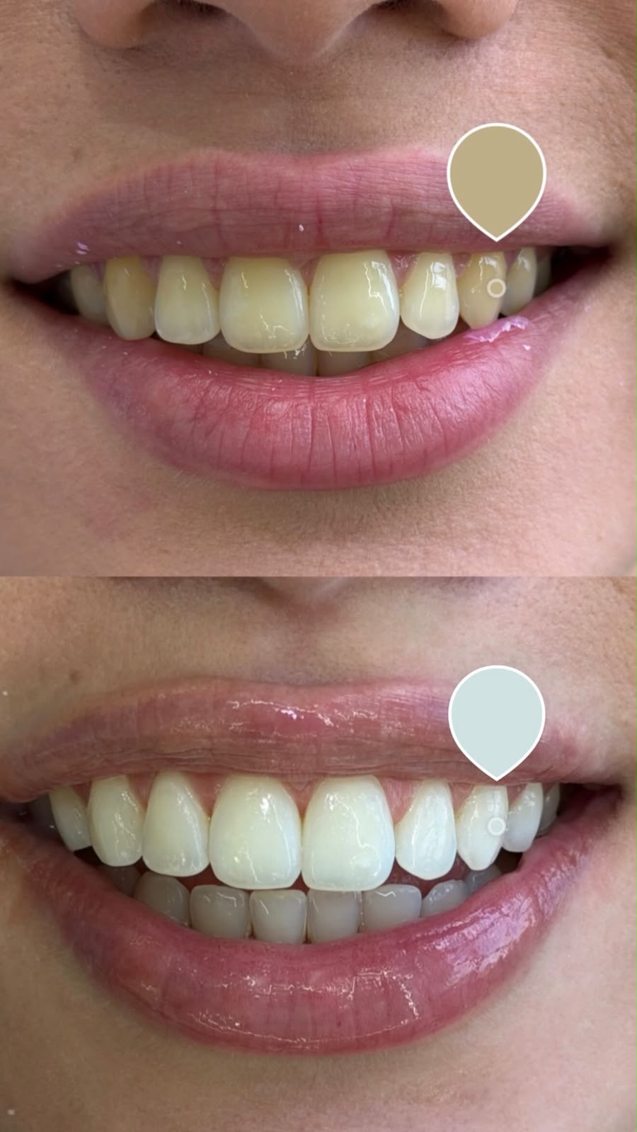 Foto de tratamento do sorriso, imagem 1